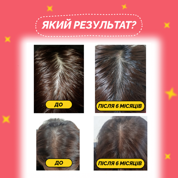 Dr.ForHair Folligen Tonic Стимулюючий тонік для росту волосся 120 ml, 120 ml